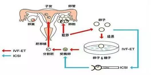 泉州试管婴儿